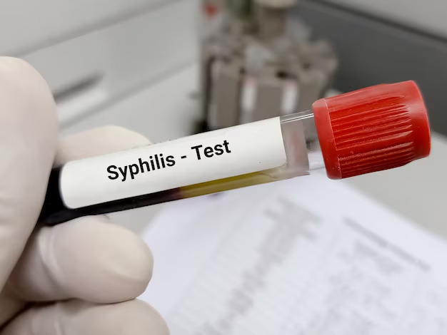 Syphilis Testing