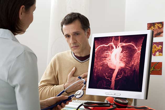 What is angiography?