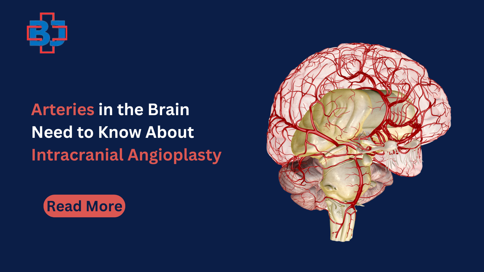 Arteries in the Brain