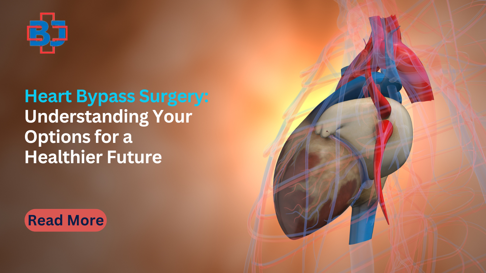 heart bypass surgery