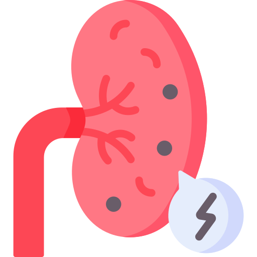 Kidney stones