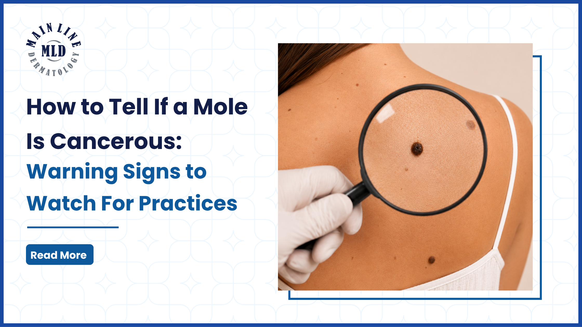 how to tell if a mole is cancerous 