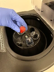 Fixed angle rotor centrifuge of the type still used in many other clinics