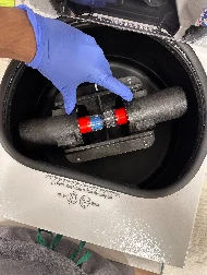 FDA-cleared horizontal rotor centrifuge used to separate platelet-rich plasma