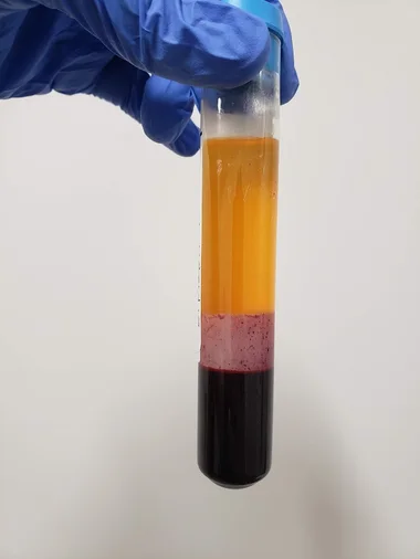 Centrifuged blood tube with the separated plasma layer sitting above the red blood cells