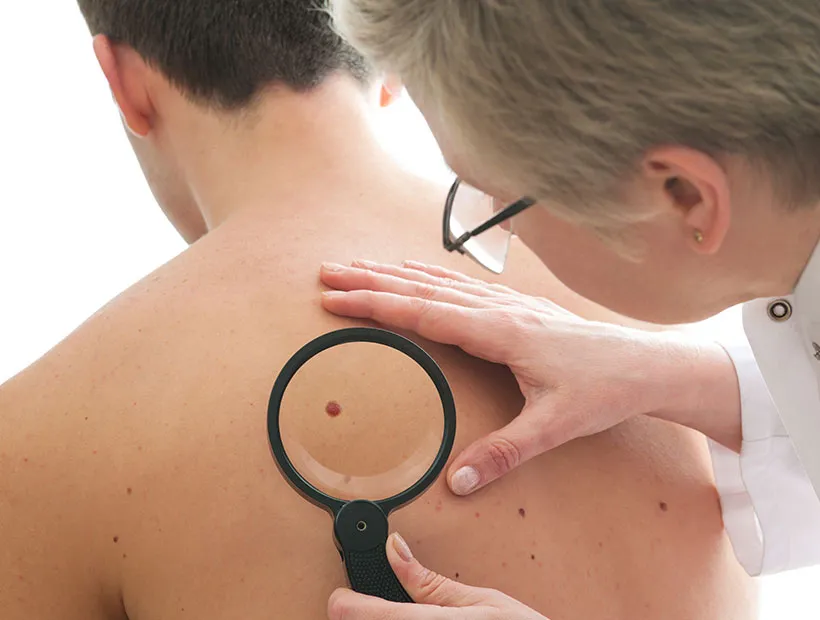 Dermatologist performing a full-body skin cancer screening