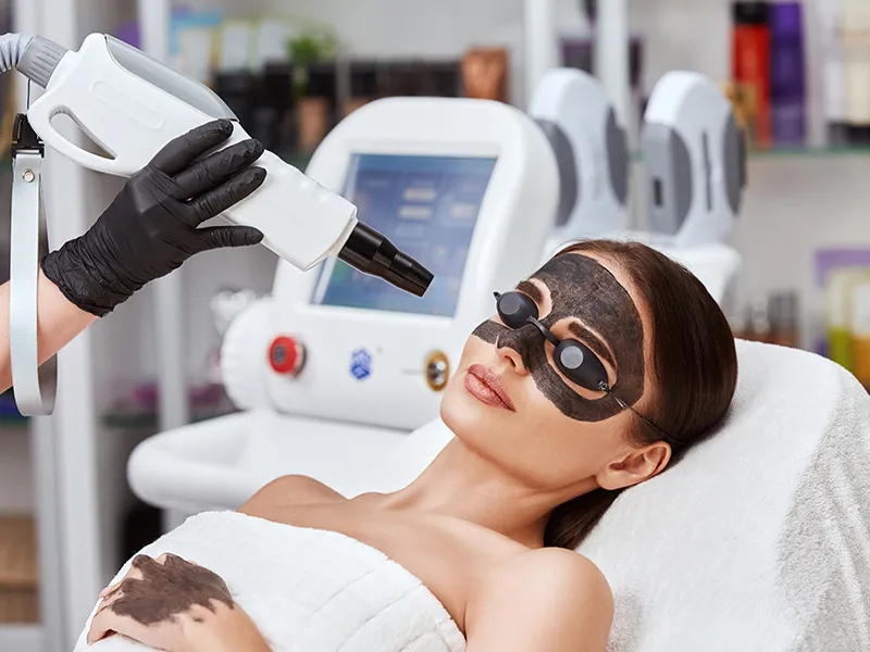 Carbon Laser at Velora Face Clinic