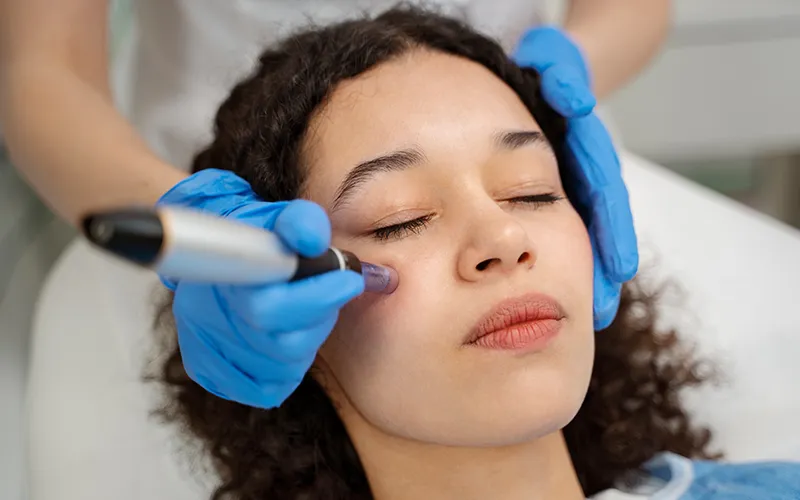 Laser Skin Resurfacing