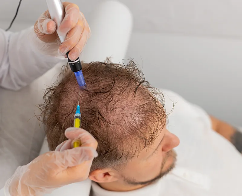 Why Choose Velora Face Clinic for QR678 Hair Loss Treatment