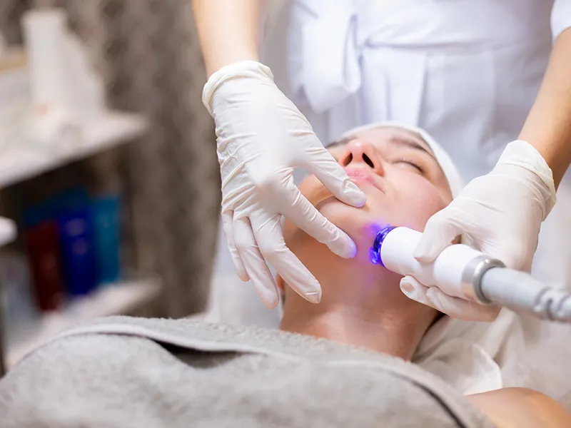 RF Treatments at Velora Face Clinic