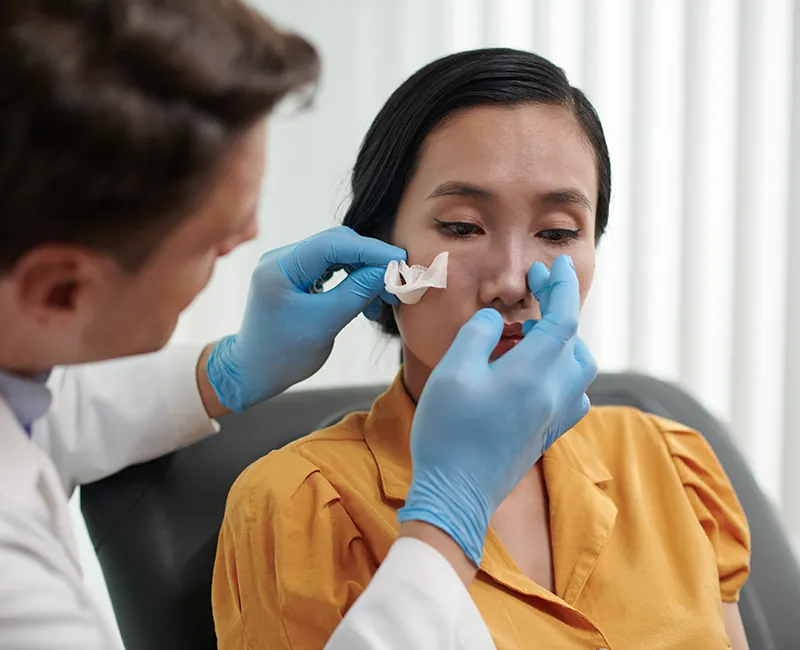 Rhinoplasty at Velora Face Clinic