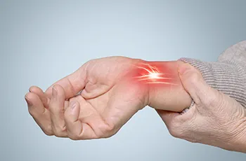 Carpal Tunnel Syndrome