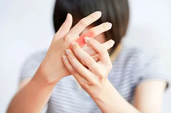 Fractures & Dislocations