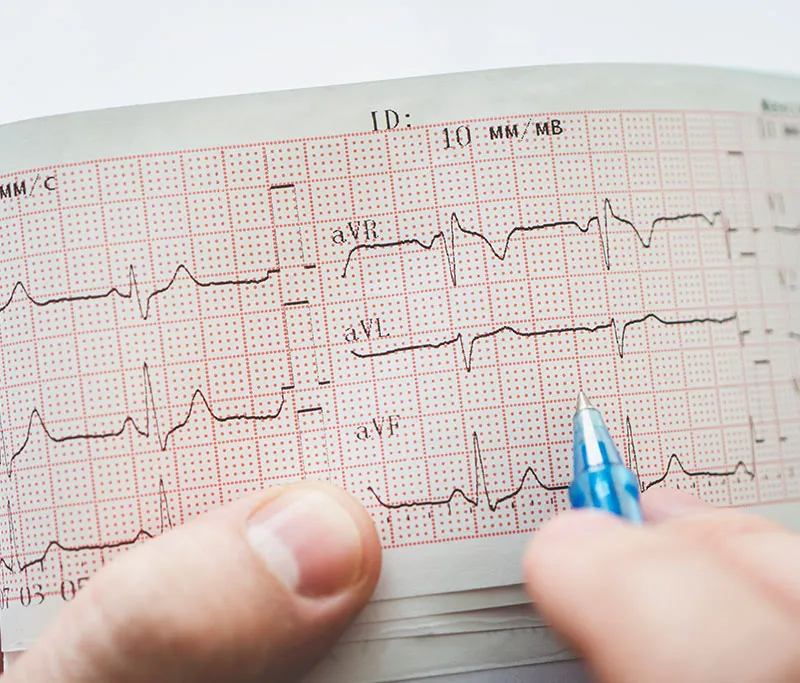 Telemeter Stress EKG for Personalized Heart Monitoring