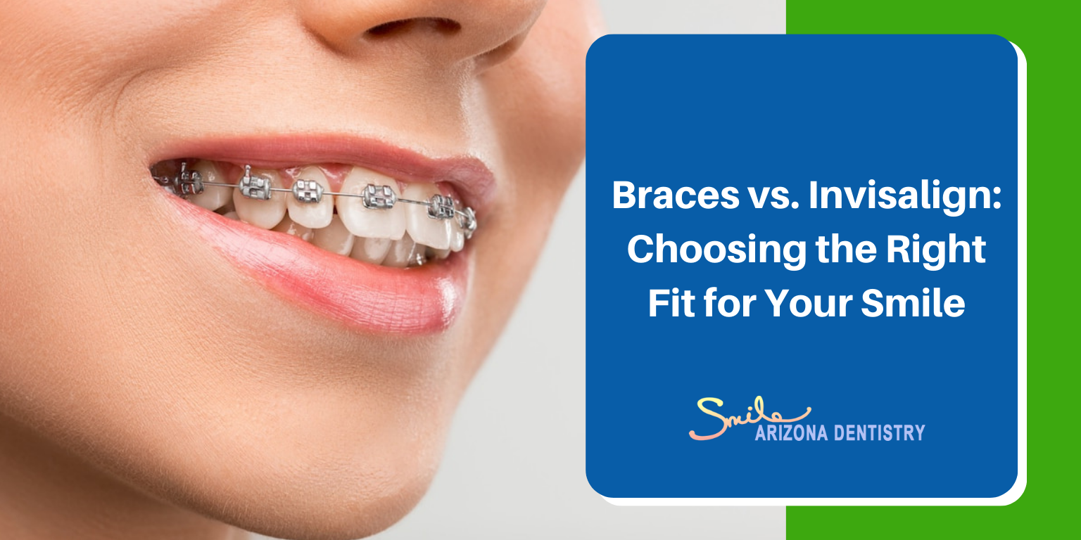 Braces vs. Invisalign: Comparing Orthodontic Options for a Perfect Smile