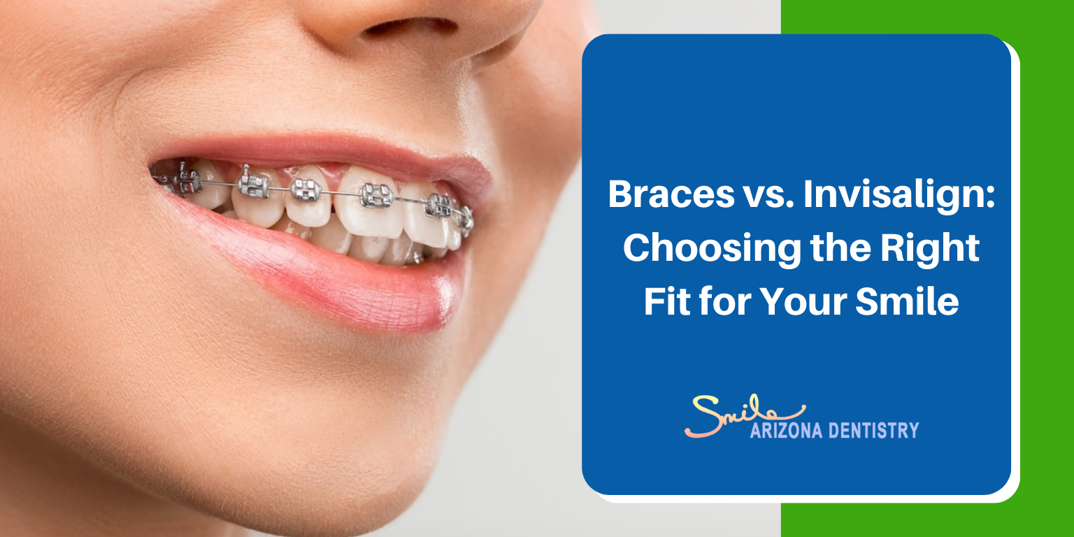 braces vs invisalign