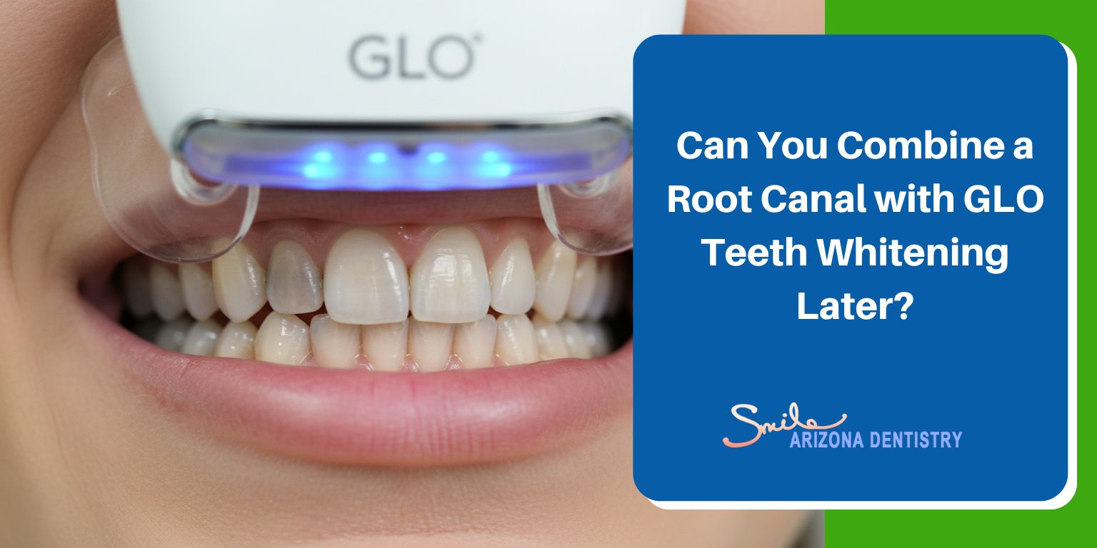 Can You Combine a Root Canal with GLO Teeth Whitening Later?