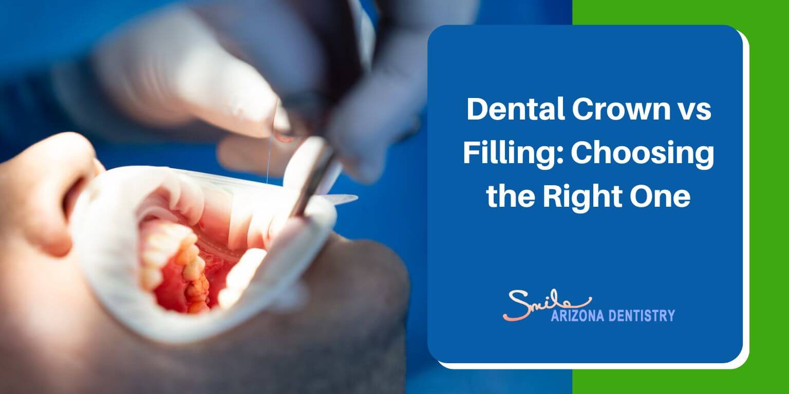 Dental Crown vs Filling: Choosing the Right One