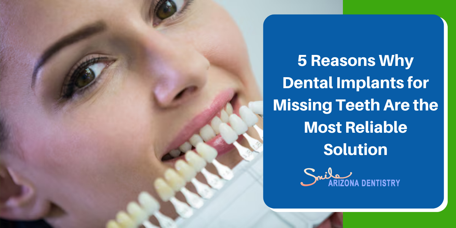 5 Reasons Why Dental Implants for Missing Teeth Are the Most Reliable Solution