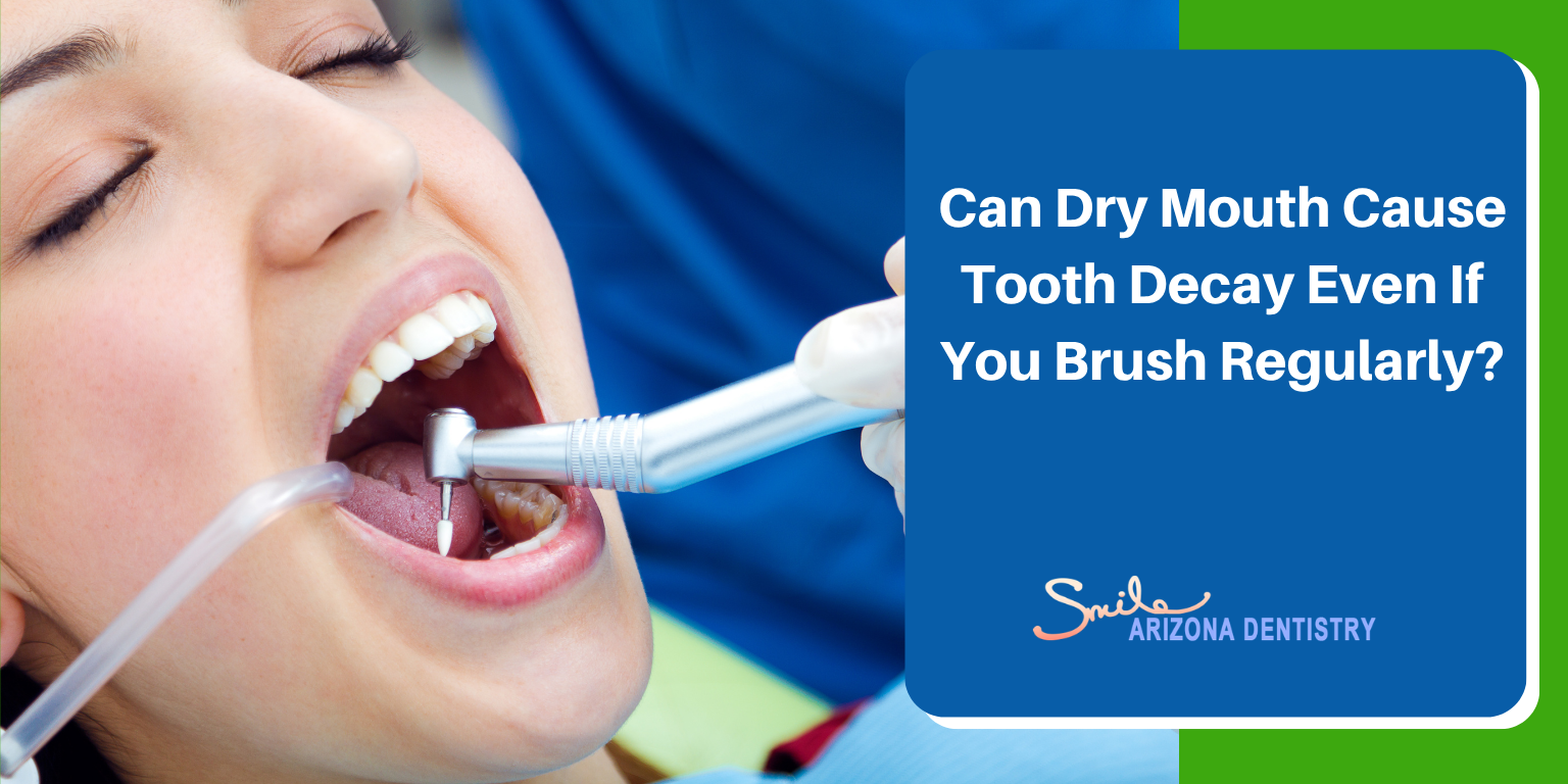 Can Dry Mouth Cause Tooth Decay Even If You Brush Regularly?