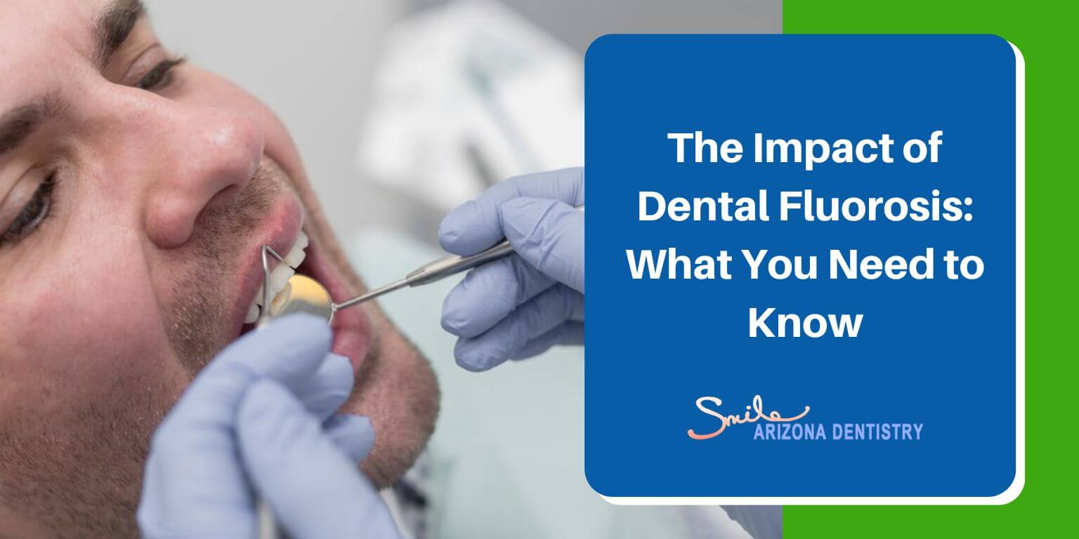 The Impact of Dental Fluorosis: What You Need to Know