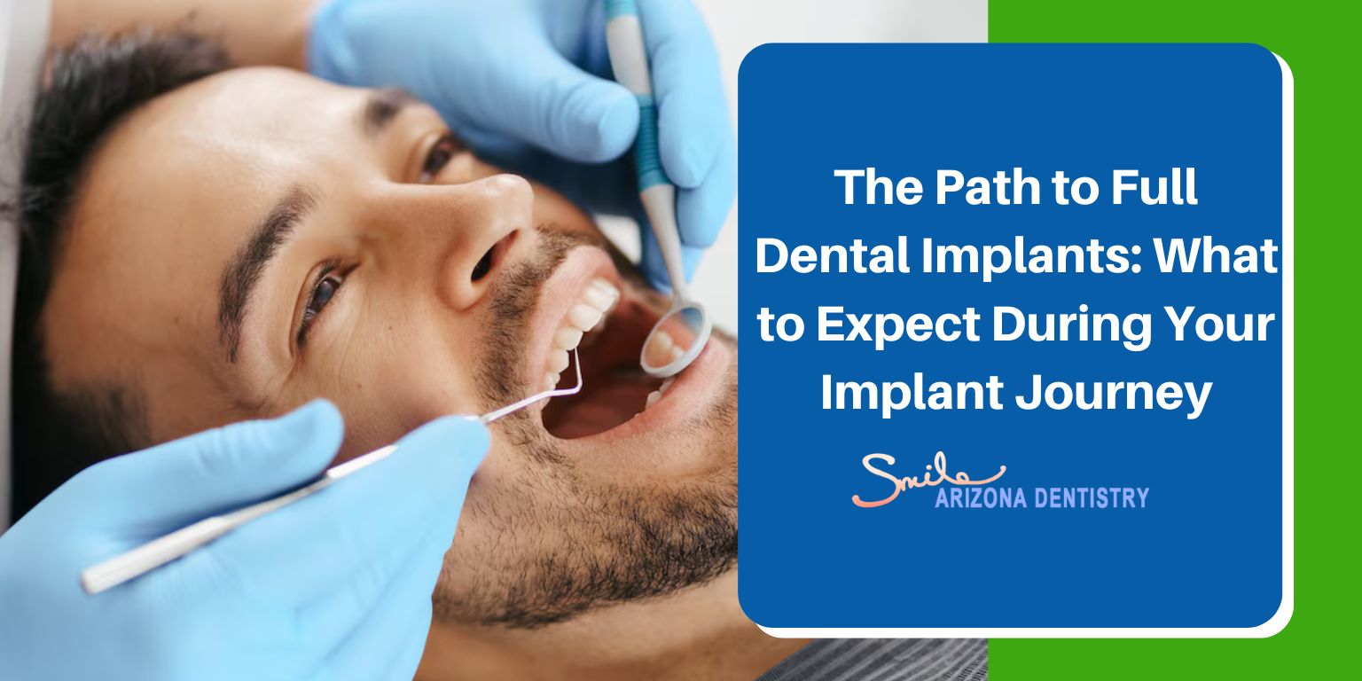 The Path to Full Dental Implants: What to Expect During Your Implant Journey