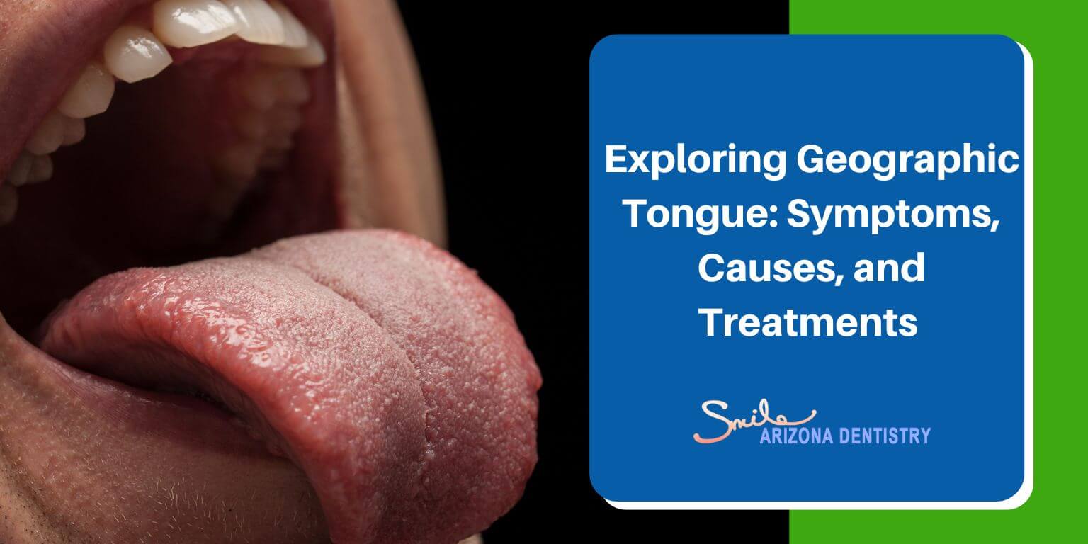 Exploring Geographic Tongue: Symptoms, Causes, and Treatments