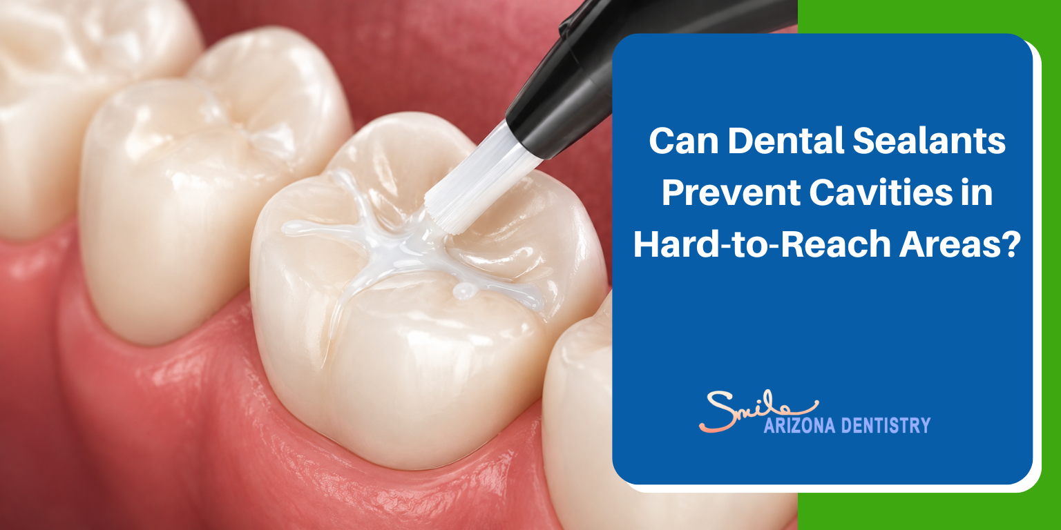 Can Dental Sealants Prevent Cavities in Hard-to-Reach Areas?