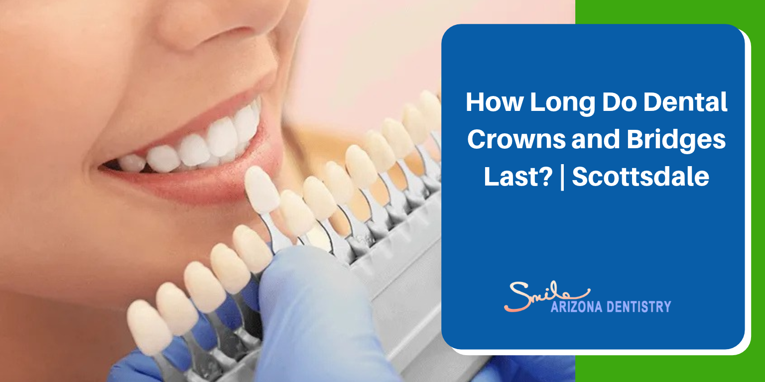 How Long Do Dental Crowns and Bridges Last? | Scottsdale