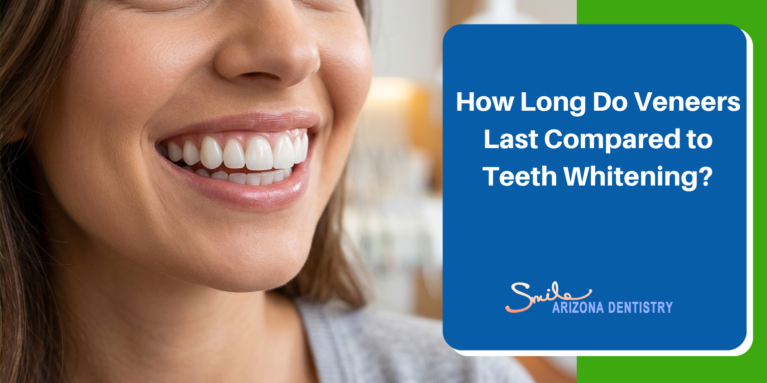 How Long Do Veneers Last Compared to Teeth Whitening?