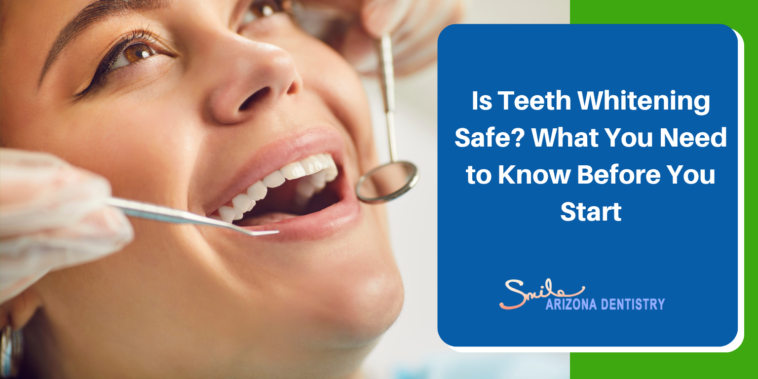 Is Teeth Whitening Safe? What You Need to Know Before You Start