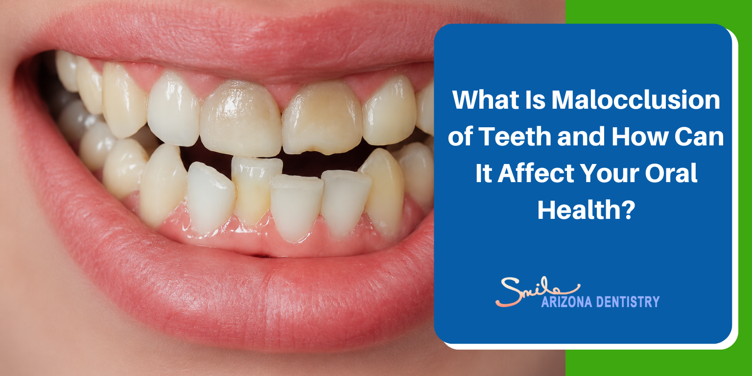 What Is Malocclusion of Teeth and How Can It Affect Your Oral Health?
