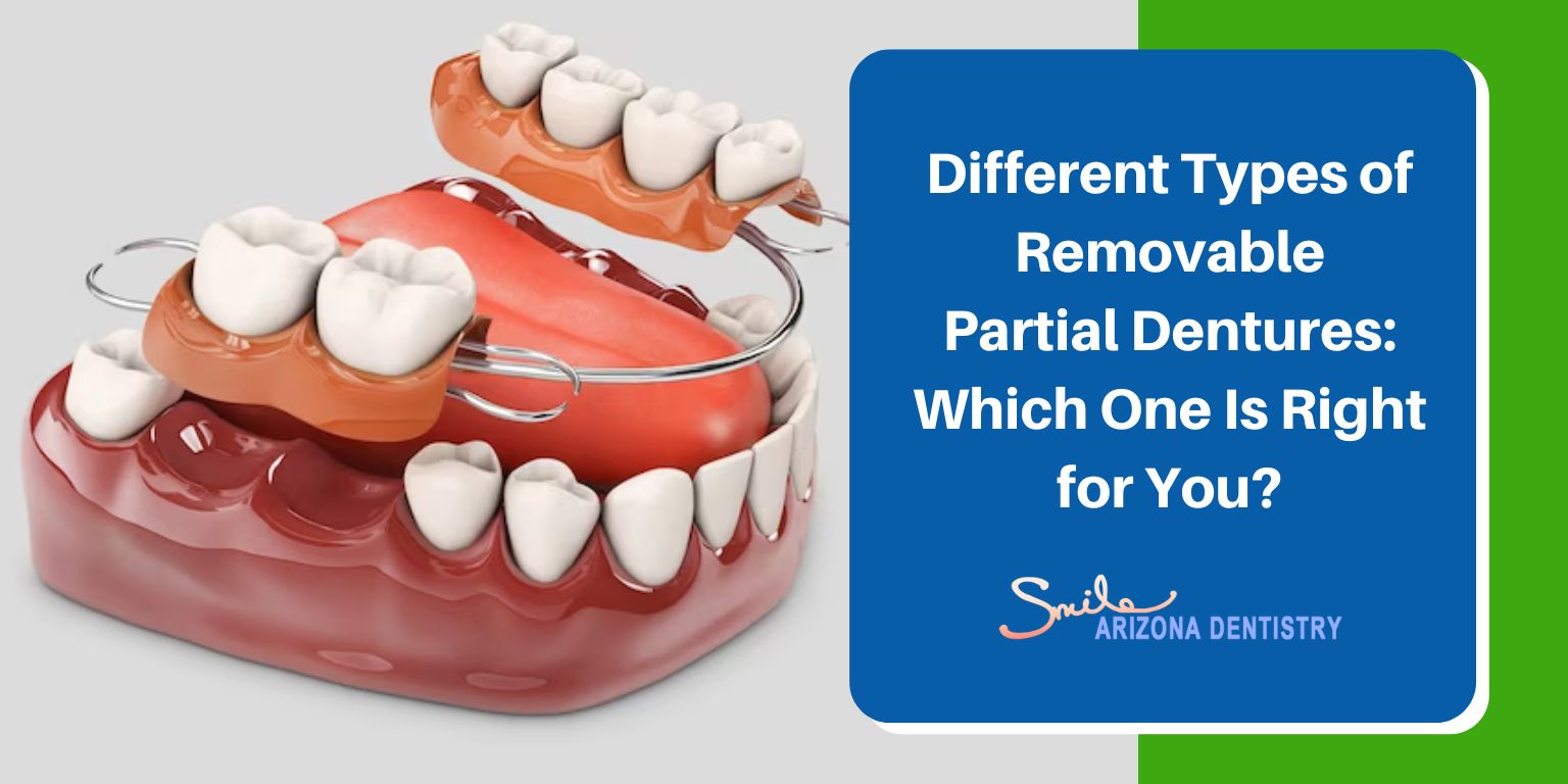 Different Types of Removable Partial Dentures: Which One Is Right for You?