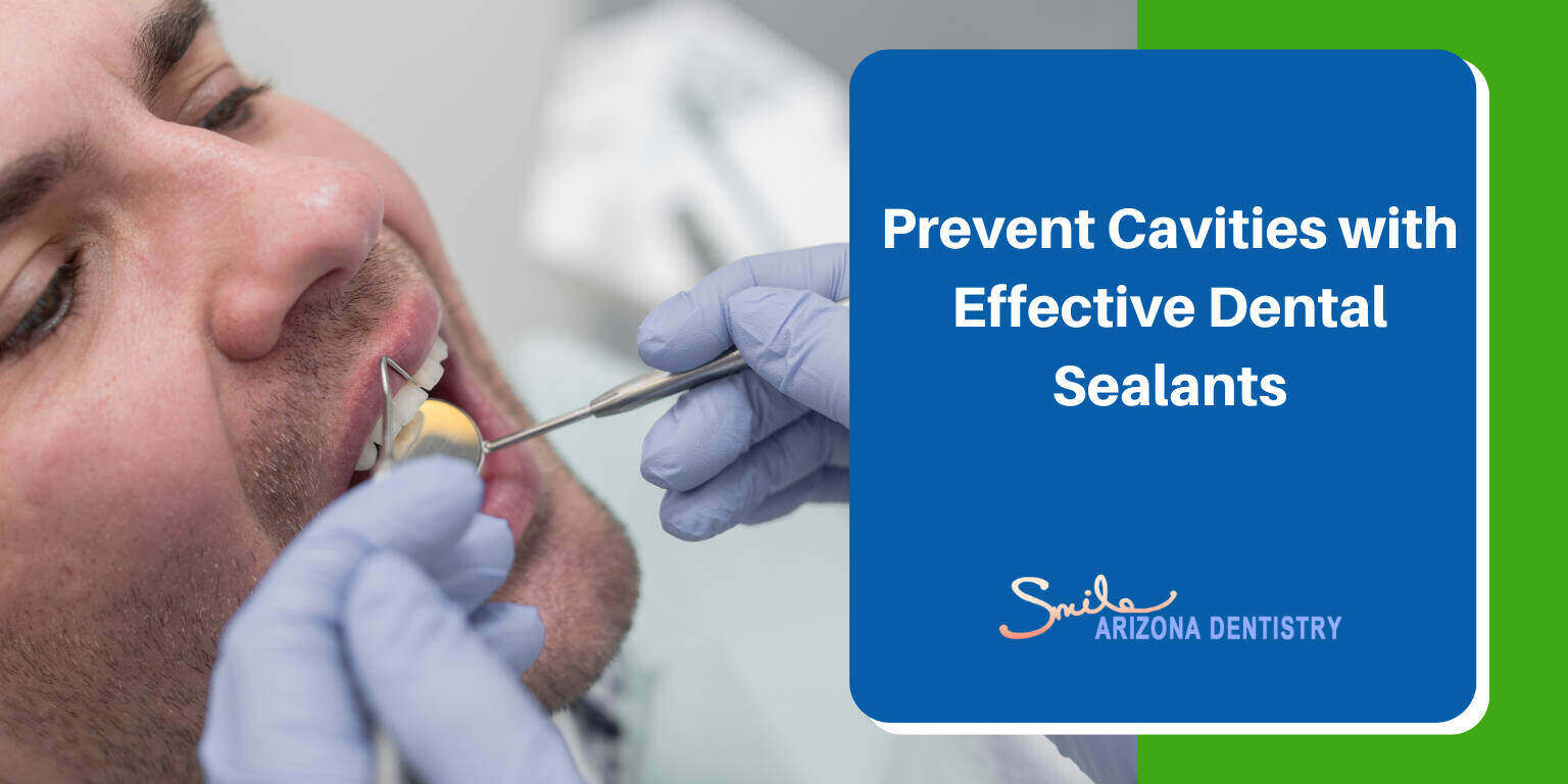 sealant for cavities