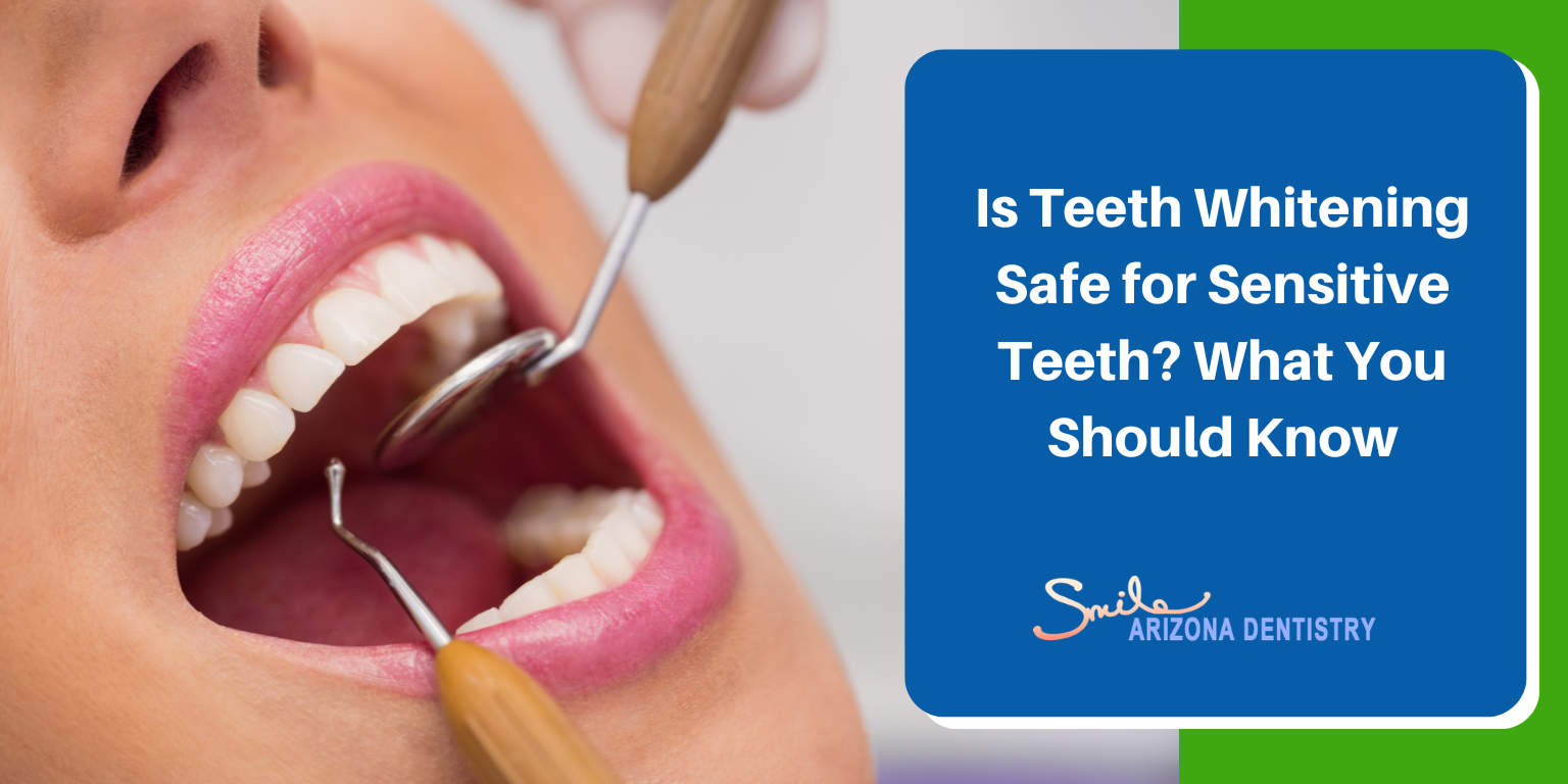 Is Teeth Whitening Safe for Sensitive Teeth? What You Should Know