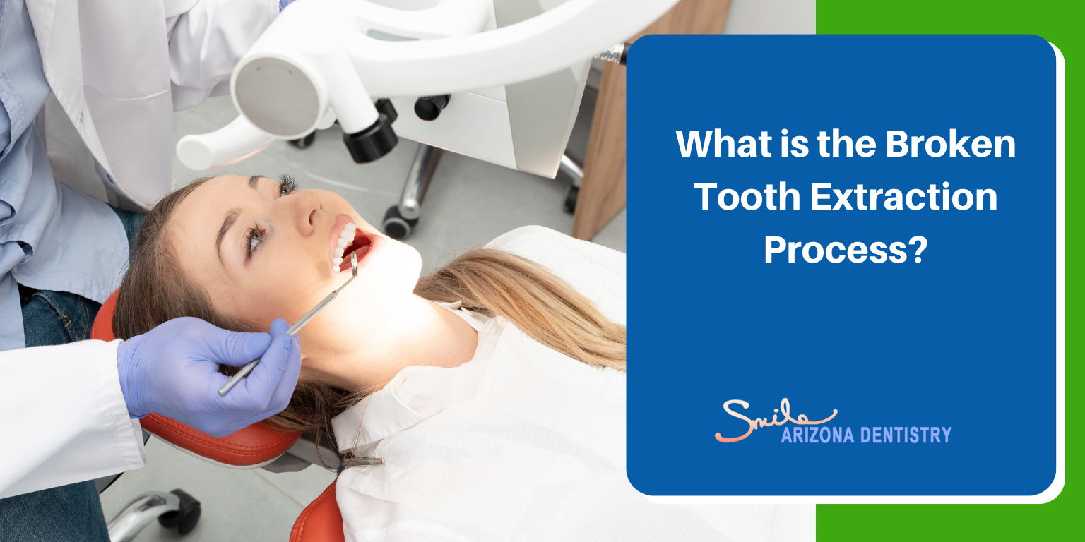 What is the Broken Tooth Extraction Process​?