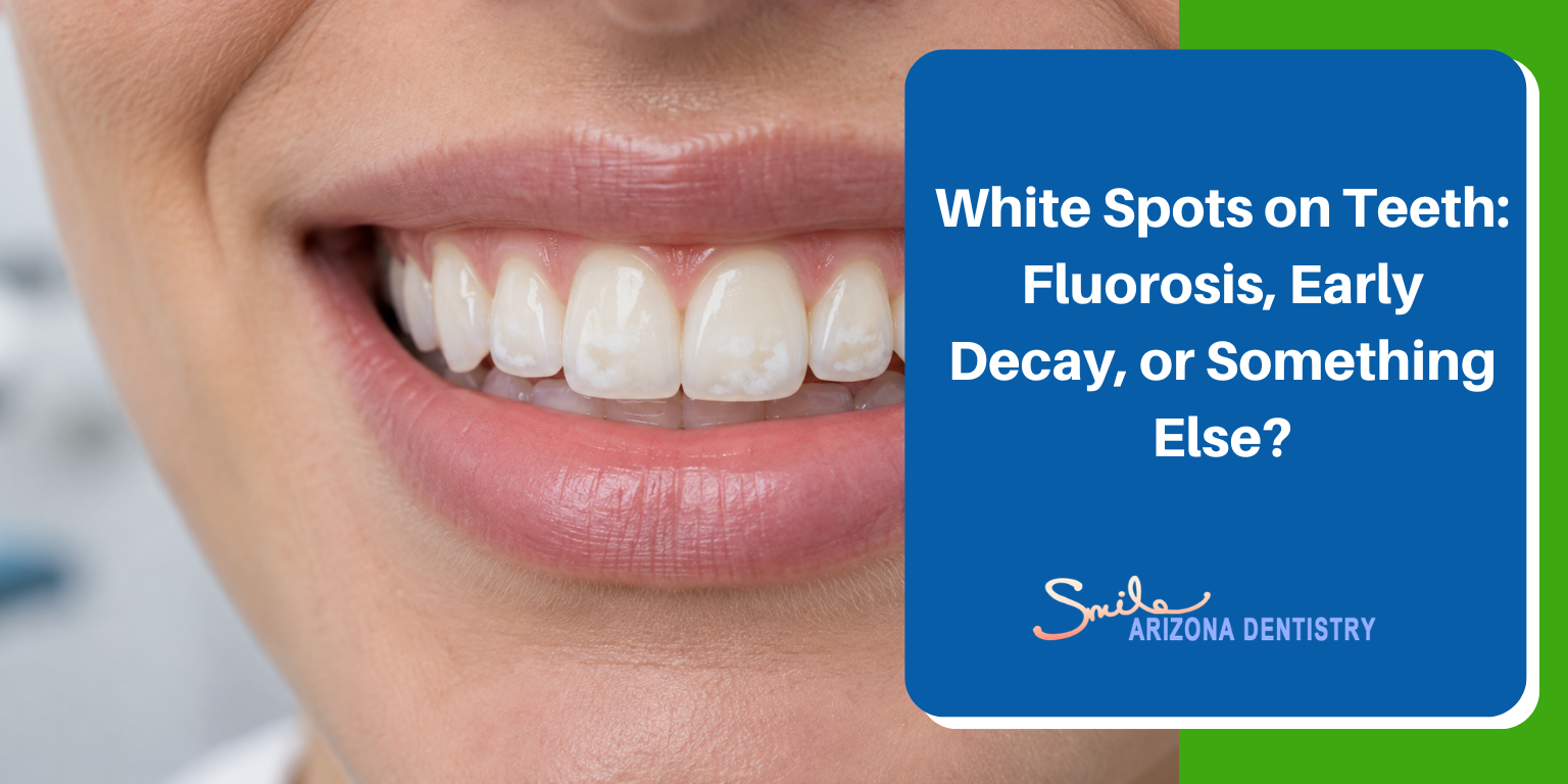 White Spots on Teeth
