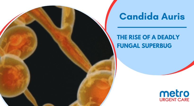 Candida Auris: The Rise of a Deadly Fungal Superbug