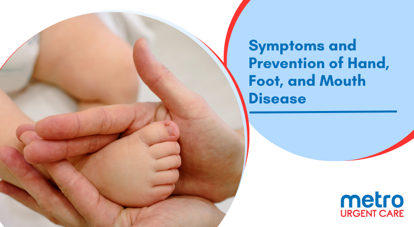 Hand-foot-and-mouth disease Hand-foot-and-mouth disease