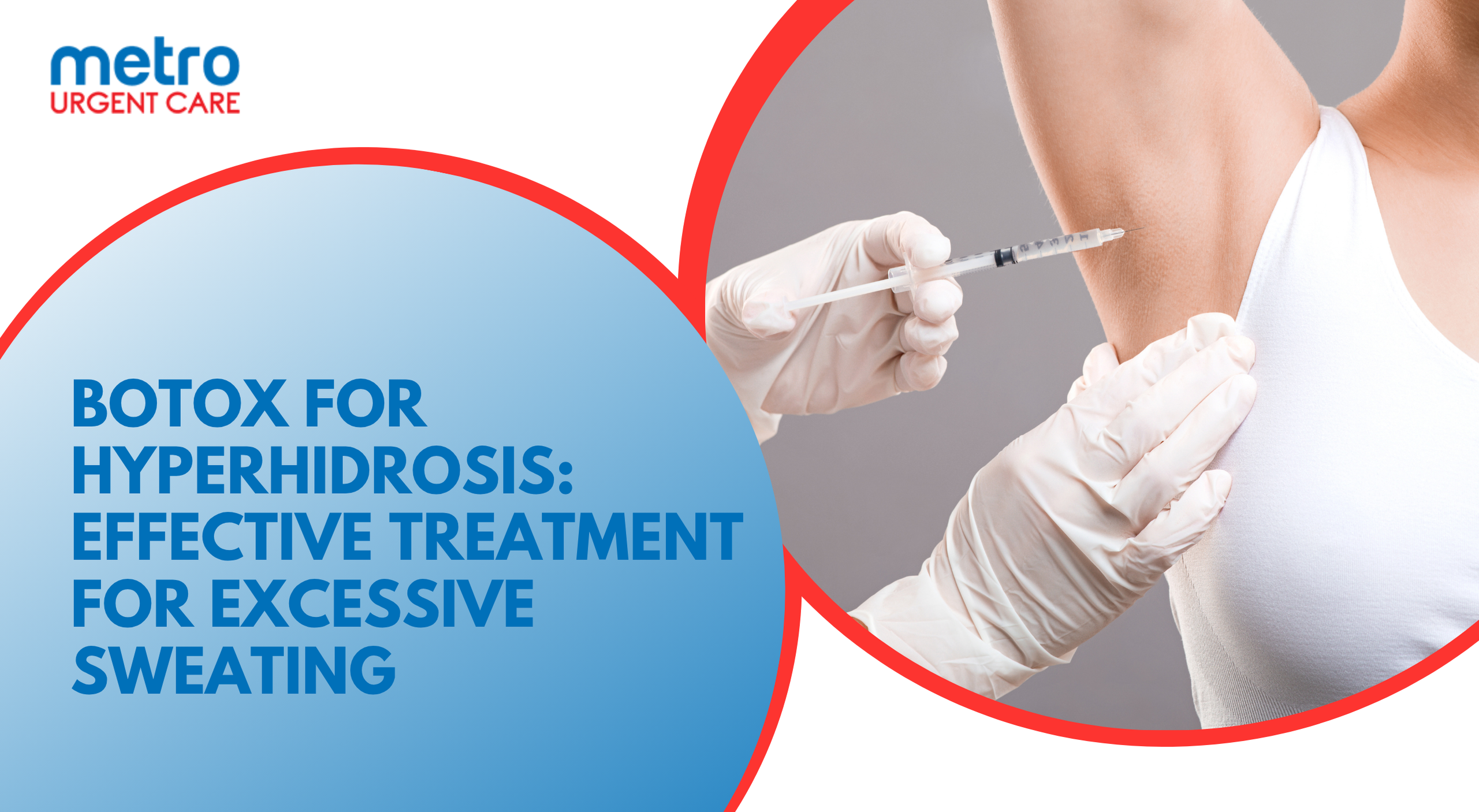 Patient receiving Botox injections for underarm hyperhidrosis treatment at Metro Urgent Care