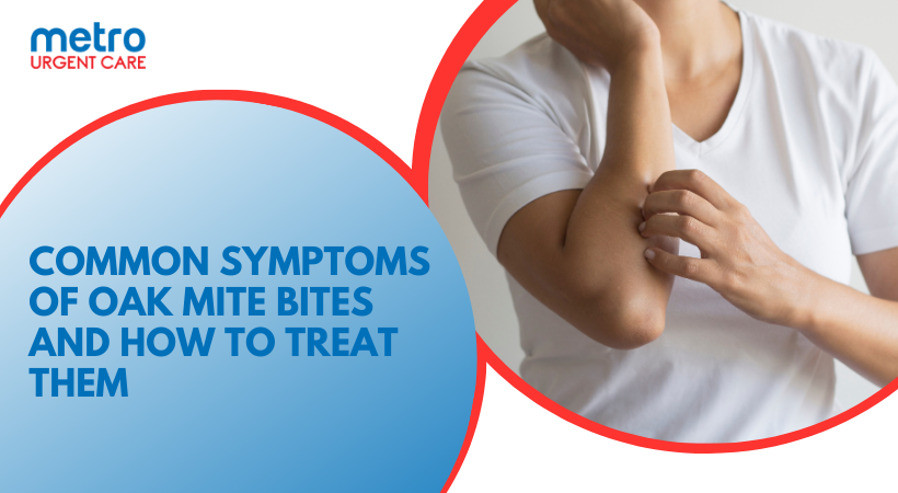 Common Symptoms of Oak Mite Bites and How to Treat Them