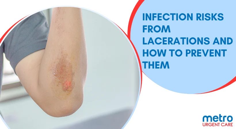 Infection Risks From Lacerations and How to Prevent Them