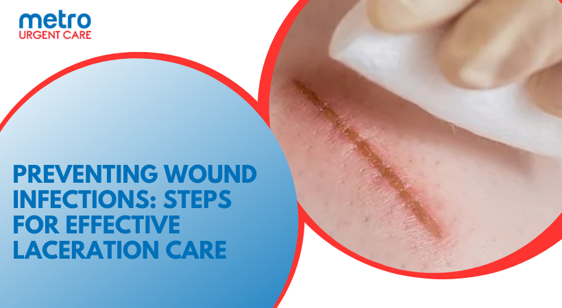 Preventing Wound Infections: Steps for Effective Laceration Care