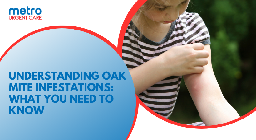 Oak Mite Infestations: How They Affect Your Health and Environment