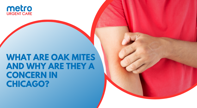 What Are Oak Mites and Why Are They a Concern in Chicago?