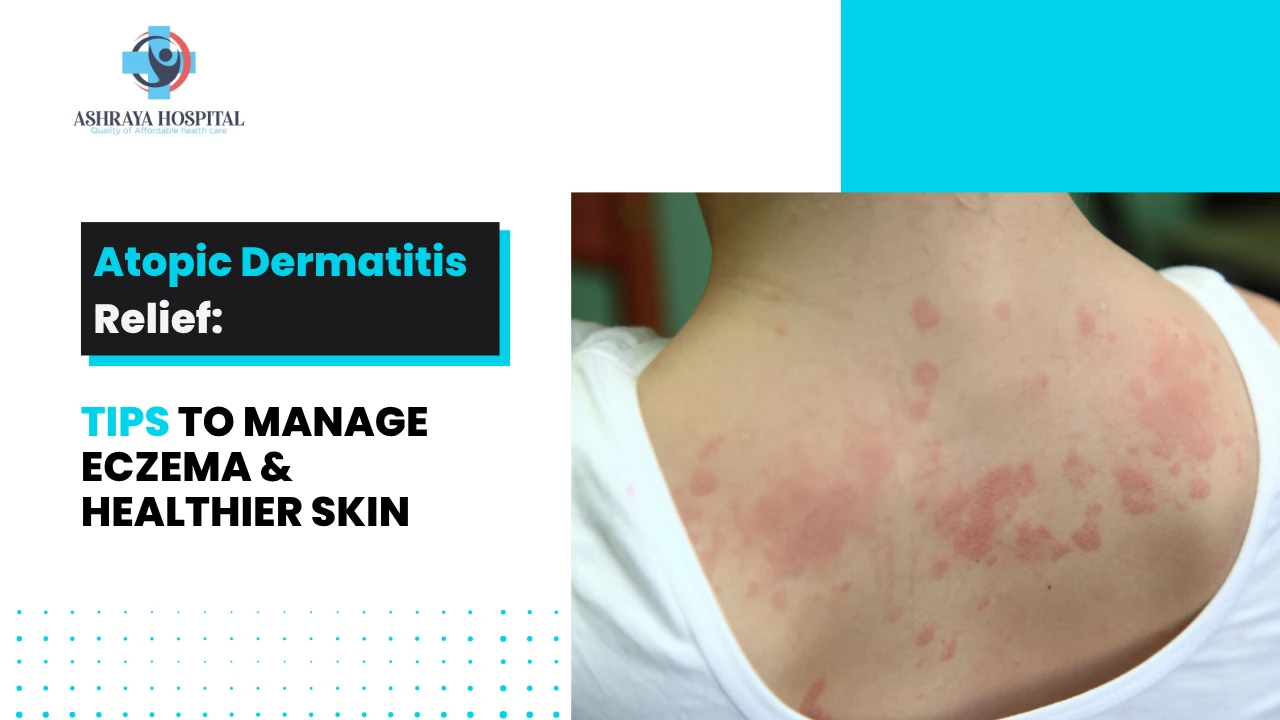 Atopic dermatitis relief tips to manage eczema and promote healthier skin, featuring a close-up of eczema-affected skin on the shoulder.