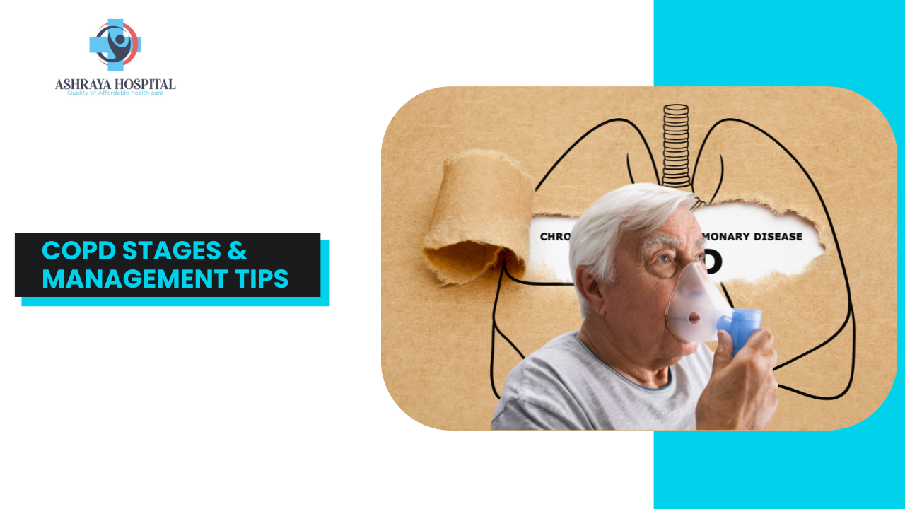 What Are the Stages of COPD and How Do I Manage Them?