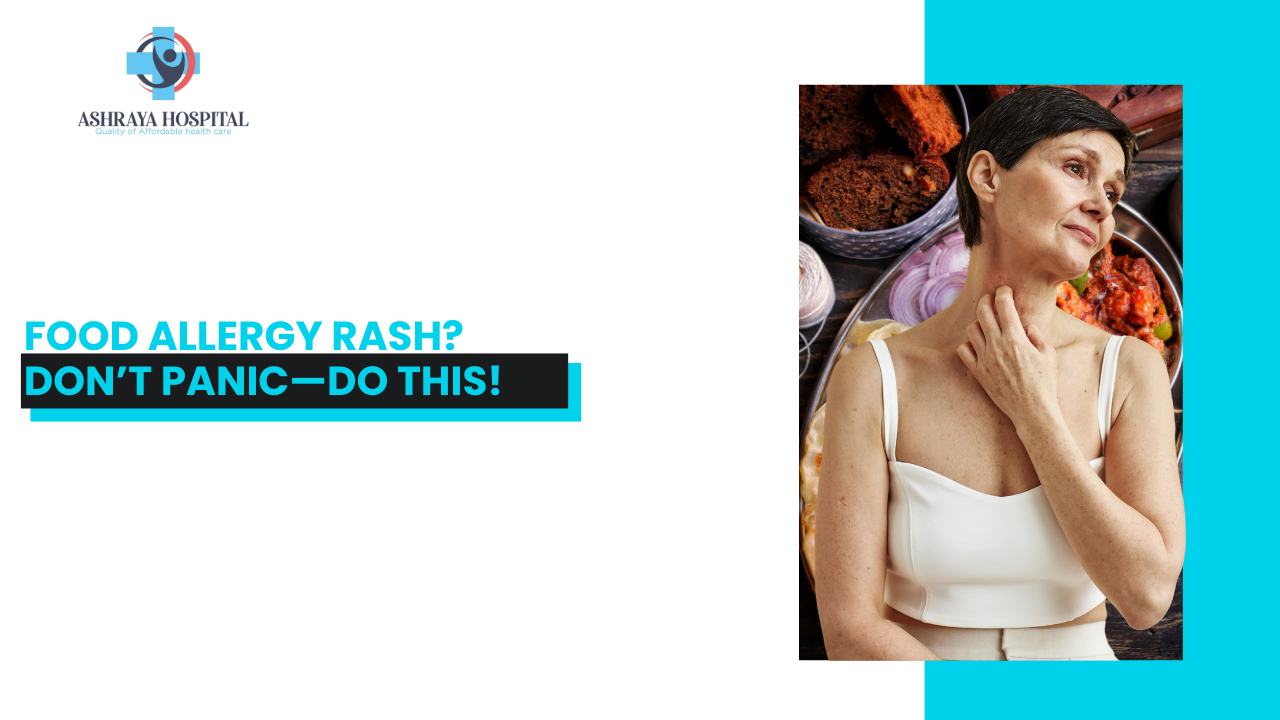 What to Do When You Get a Food Allergy Rash on Your Skin?