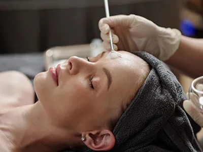 Chemical or Enzyme Peels