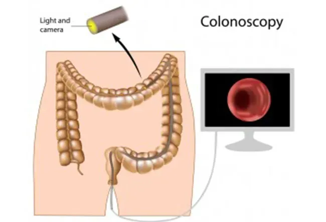 Preparation for Procedures